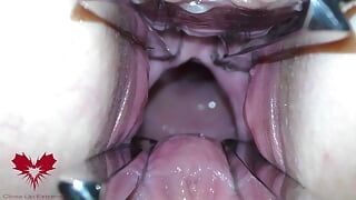 The mistress’ cunt is opened with a hole expander so that you can study her cervix.